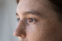 Hur blir man av med pigmentfläckar i ansiktet? Hur blir man av med pigmentfläckar i ansiktet?